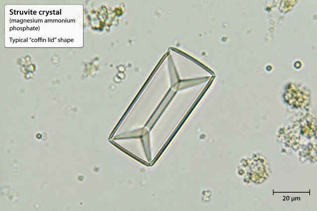 Struvite Crystals in Cats: Symptoms, Causes, Diagnosis and Treatment
